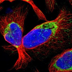 CCDC44 Antibody, Novus Biologicals:Antibodies:Primary Antibodies